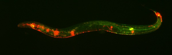 Fluorescent neurons in nematode